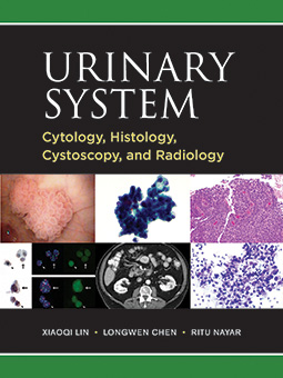 urinary system