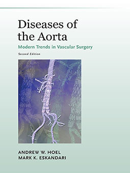 Diseases of the Aorta cover image